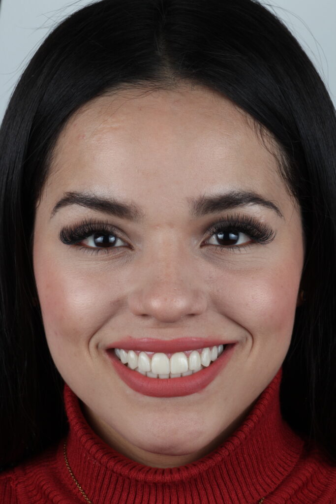 IMG 0446 1 683x1024