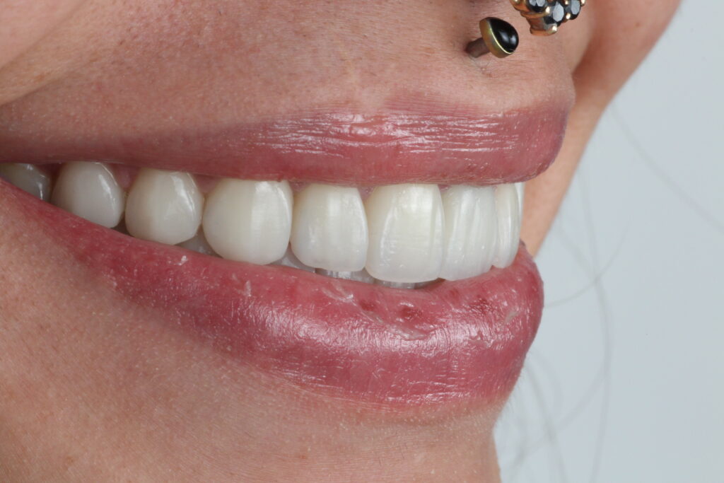 IMG 0992 1 1024x683