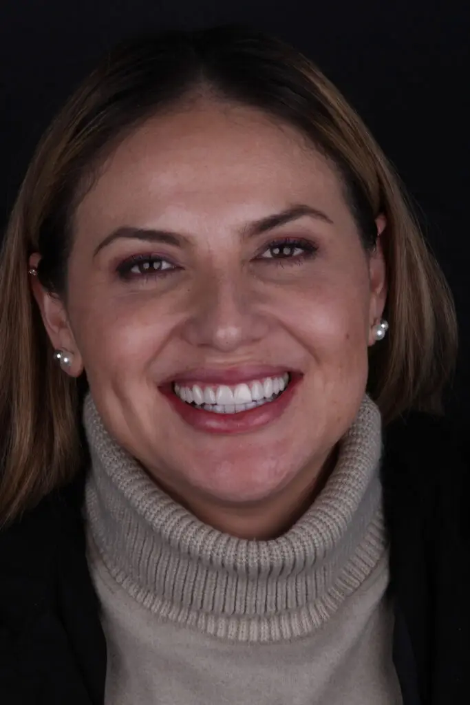diseño de sonrisa en tijuana